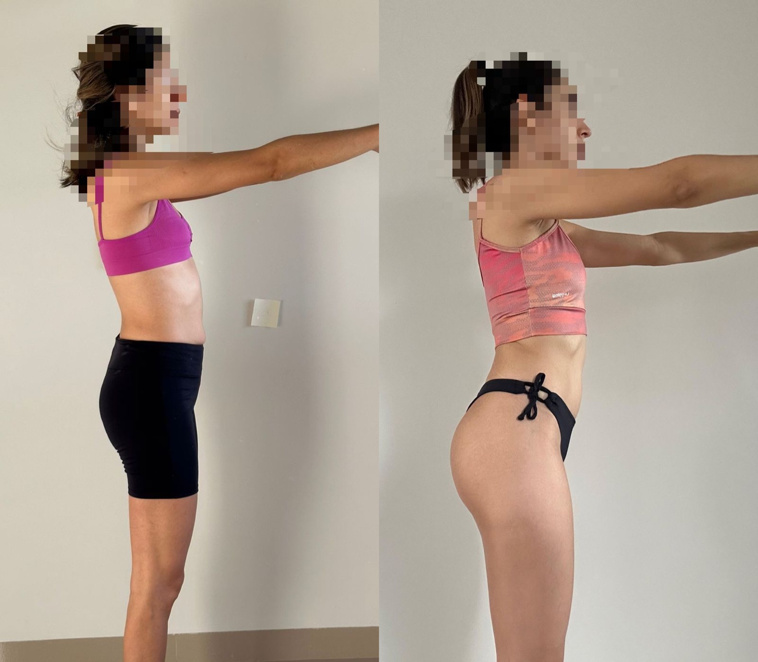 Antes e depois 2